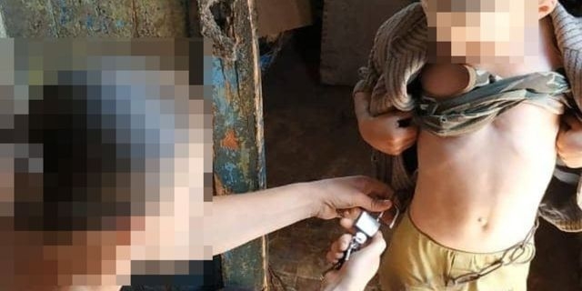 Отец, посадивший ребенка на цепь, ответит по двум статьям УК Украины
