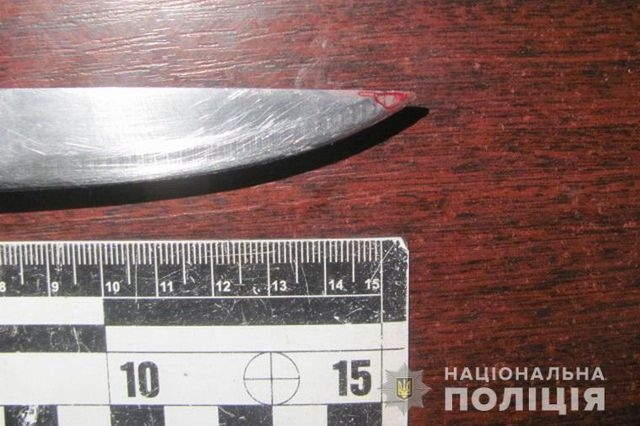 Свидание закончилось поножовщиной – молодой мужчина попал в реанимацию