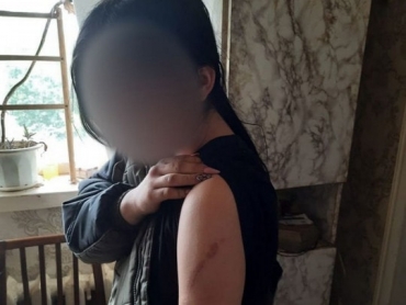 Чтобы не убегала из дома – в Кременском районе мать держала дочь на цепи